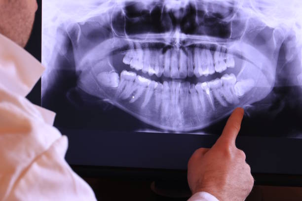 Best Emergency Denture Repair in Kingsland, TX